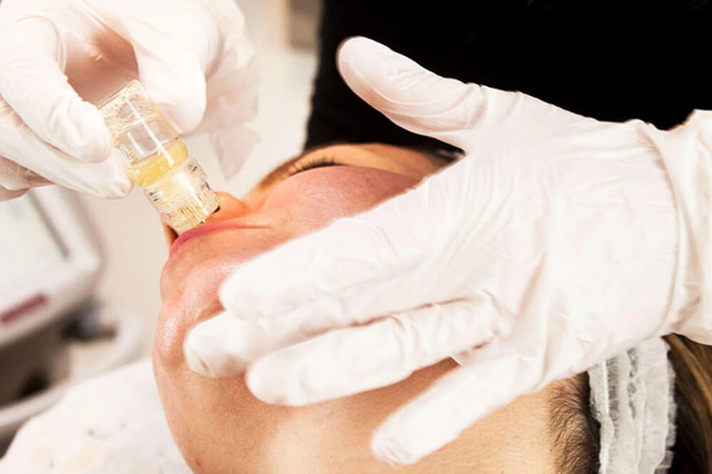 Microdermabrasion In Plainview